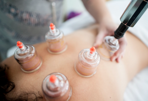 Cupping Therapy (Wet Cupping)