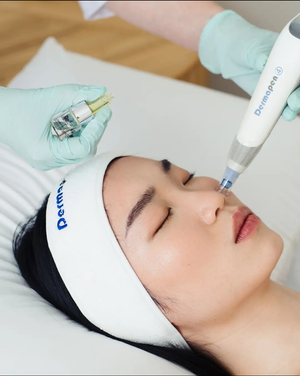 Dermapen4 Skin Needling (Package of 4)